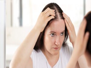 Hair Loss in Women: Causes, Treatments and More